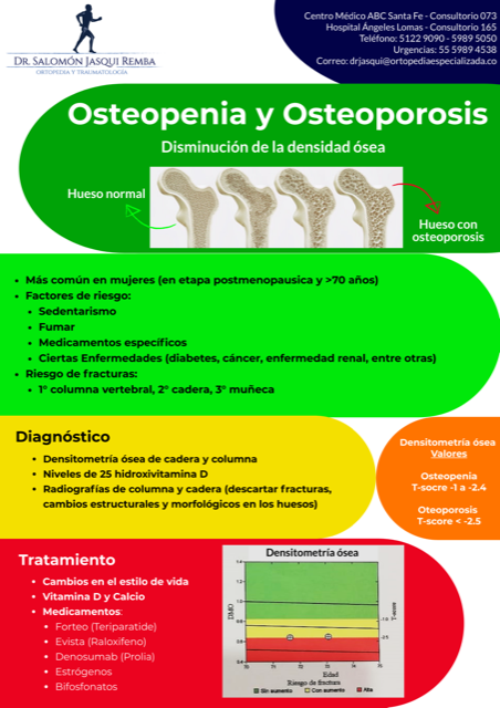Osteopenia y osteoporosis